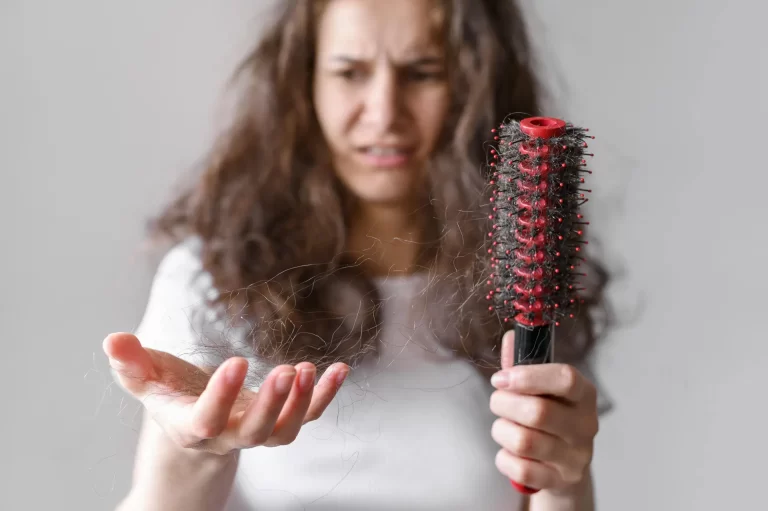 Read more about the article How to Manage Hair Shedding