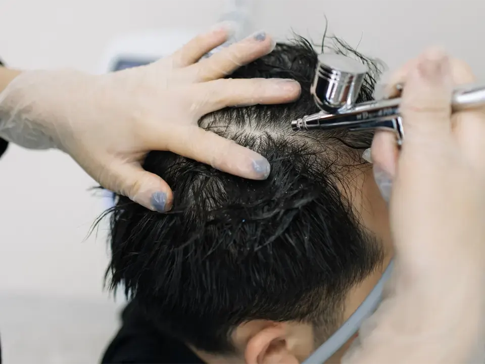 Read more about the article Seven Benefits of Scalp and Hair Therapy You Didn’t Know About